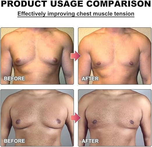 Men Therm - Bee Venom Gynecomastia Heating Oil