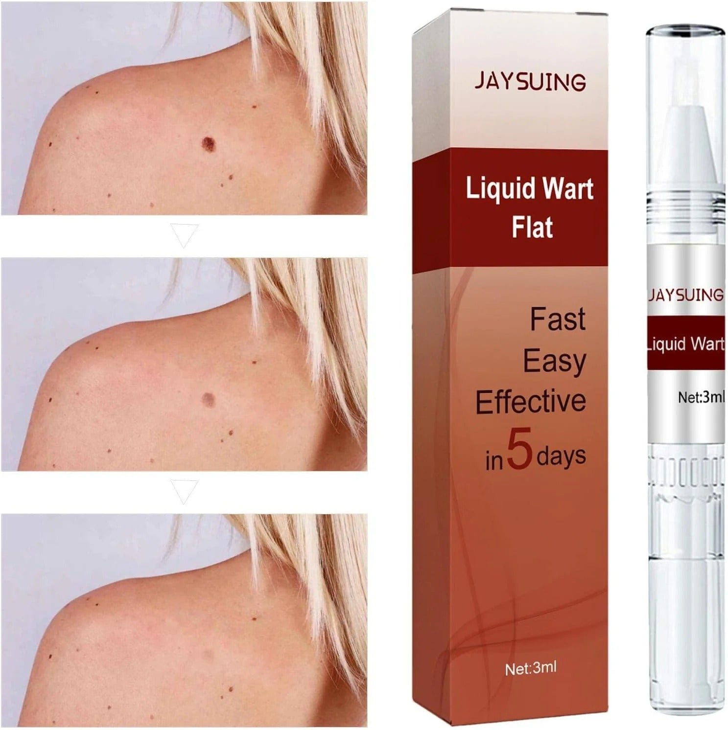 Liquid Wart Flat